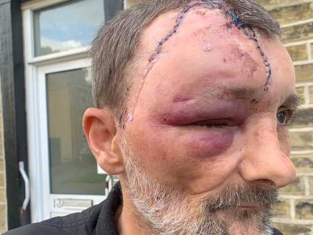Sean Ryan was attacked on Saturday afternoon.