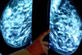 This Breast Cancer Awareness Month a senior doctor for the NHS North East and Yorkshire region is encouraging women to take up the offer of breast screening and make an appointment – even if they received an invite weeks or months ago.