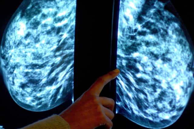 This Breast Cancer Awareness Month a senior doctor for the NHS North East and Yorkshire region is encouraging women to take up the offer of breast screening and make an appointment – even if they received an invite weeks or months ago.