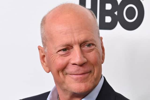 Bruce Willis has been diagnosed with frontotemporal dementia. Photo: Getty Images