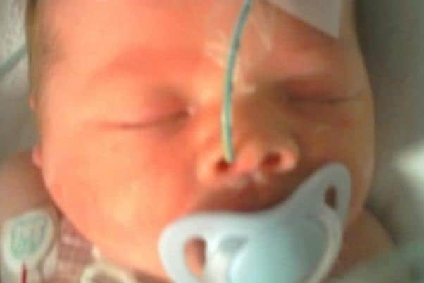 Caleb, who is now 13, needed 12-hour open heart surgery at just 2-days-old.