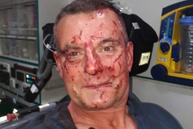 Paul Blake, 56, was beaten by thugs after leaving the Bow Legged With Brass pub in Halifax.