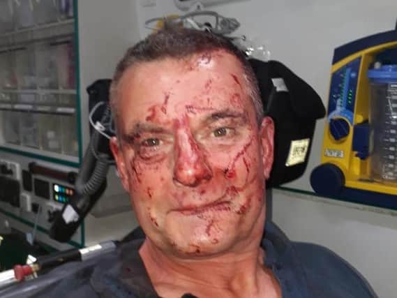 Paul Blake, 56, was beaten by thugs after leaving the Bow Legged With Brass pub in Halifax.