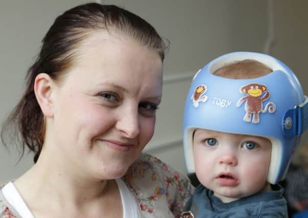 Shantelle is raising awareness of ten month old son's plagiocephaly condition.
