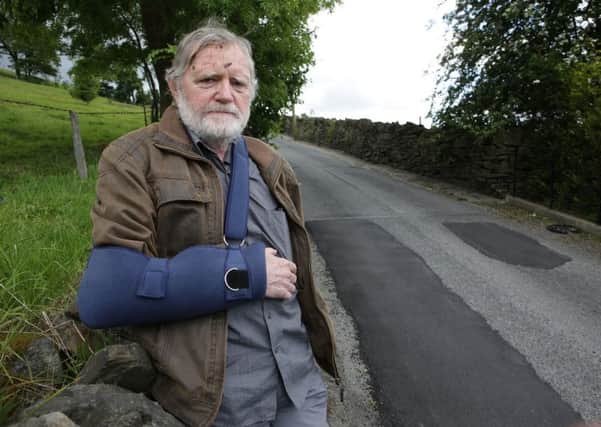 Ron Winn suffered fractured skull and fractured elbow after going over a pot hole in Rosemary Lane, Siddal.