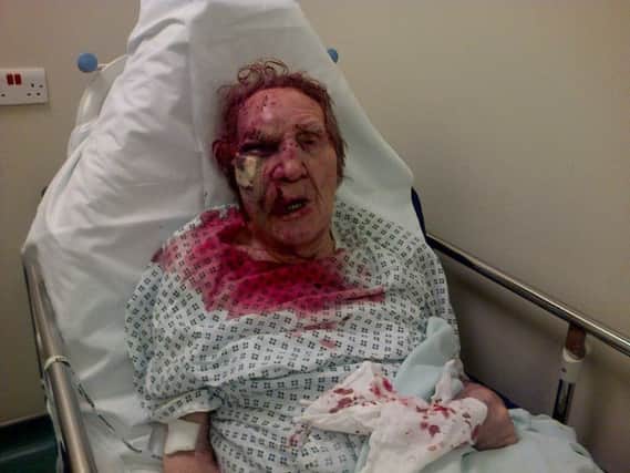 89-year-old Colin Butlin who was left with serious facial injuries after being attacked outside his home on Rochdale Road, Greetland, Halifax, West Yorkshire. See Ross Parry copy RPYBRUTAL :
Slovakian thug Viktor Lakatos who launched a brutal knuckle-duster attack on an 89-year-old defenceless jeweller has been jailed at Bradfrod Crown Court. Viktor Lakatos, 42, was eventually hunted down for the barbaric attack and received an 18-year extended prison sentence on Monday (11/1) following a complex police inquiry. The shocking snaps of Colin Butlin's bloodied and battered face were first published in November 2014 - in an attempt to track down his attacker. Bradford Crown Court heard that the hard-working pensioner, who travelled daily to his jewellery store in Keighley, West Yorks., had died a few days after his 90th birthday last summer - never knowing if his attacker would be condemned to prison.
