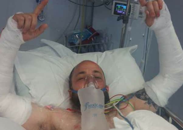 Injured mountain bike rider Peter Wilson recovers in hospital after accident at Todmorden. He borke both arms - but his bike was fine!