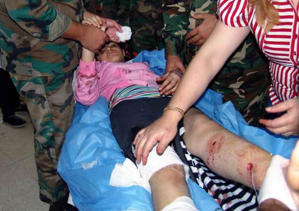 In this photo released by the Syrian official news agency SANA, an injured girl lies on a bed as she gets treatment in a hospital in the southern city of Daraa, Syria, on Tuesday. Rebels fired rockets at government-held areas. One hit a primary school, killing six people among them five children and wounding 18 students, according to state-run news agency SANA. It said some of the wounded are in a serious condition