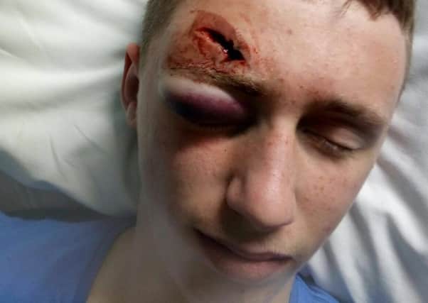 Benjamin Goga, 14, who was seriously injured after playing at the derelict Old Lane Mill, Halifax